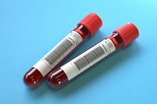 AACR News Liquid Biopsies