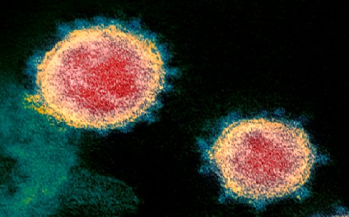 coronavirus2